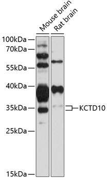 Anti-KCTD10 Antibody (CAB12115)