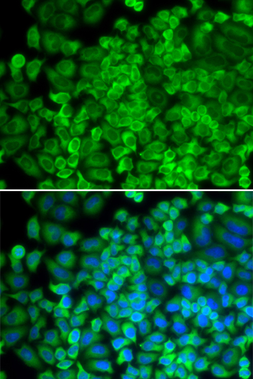 Anti-GLA Antibody (CAB1700)