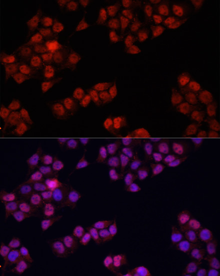 Anti-YAP1 Antibody (CAB11265)