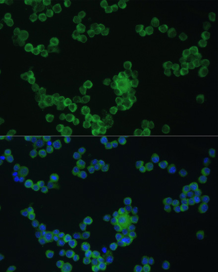 Anti-CD80 Antibody (CAB16039)