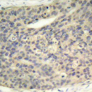 Anti-Phospho-LIM domain kinase 1-T508 Antibody (CABP0387)