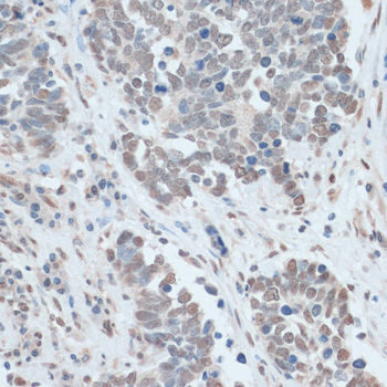 Anti-ZNF707 Antibody (CAB13737)