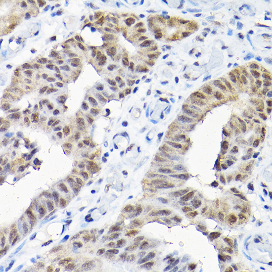 Anti-SNRPF Antibody (CAB12162)