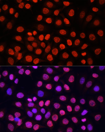 Anti-Pan DiMethyl-lysine Antibody (CAB5870)