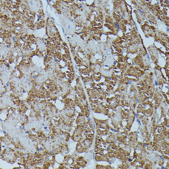 Anti-FKBP1B Antibody (CAB16375)