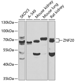 Anti-ZNF20 Antibody (CAB7346)