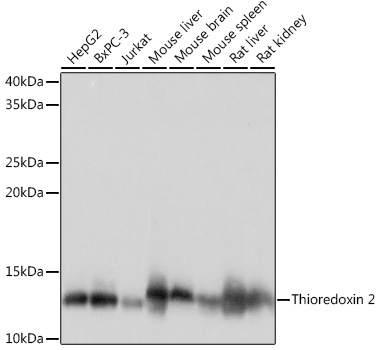 Anti-Thioredoxin 2 Antibody (CAB4424)