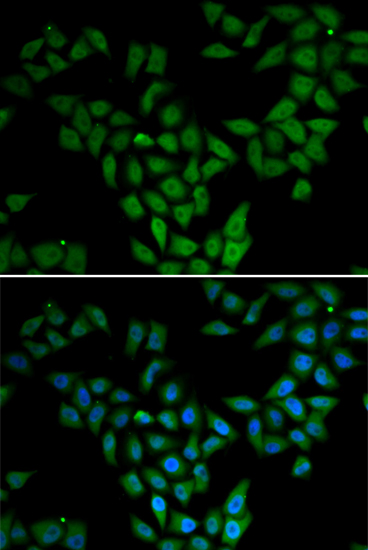 Anti-ASF1A Antibody (CAB6528)