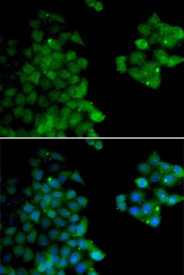 Anti-PSMB10 Antibody (CAB5452)