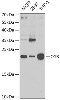 Anti-CGB Antibody (CAB1817)