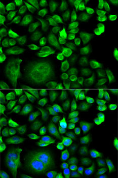 Anti-MSMB Antibody (CAB13625)