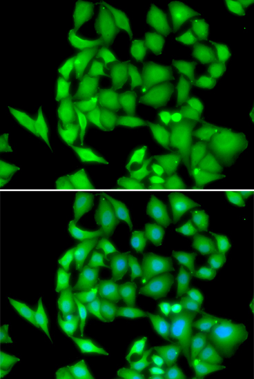 Anti-NEK3 Antibody (CAB6665)