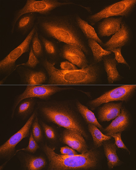 Anti-LMAN1 Antibody (CAB10440)