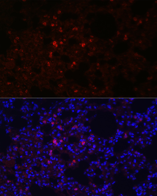 Anti-SFTPC Antibody (CAB1835)