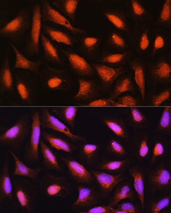 Anti-GMFB Polyclonal Antibody (CAB8652)