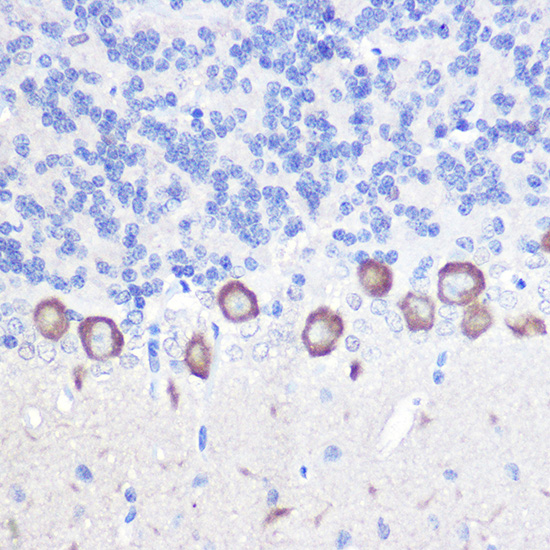 Anti-PLCB3 Antibody (CAB10236)