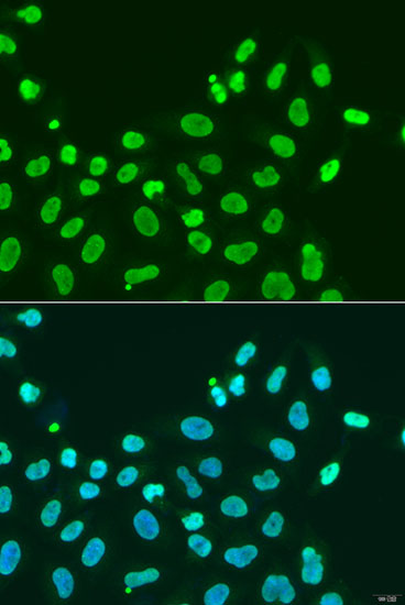 Anti-CBX5 Antibody [KO Validated] (CAB12577)