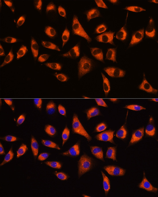 Anti-GNB2 Polyclonal Antibody (CAB8422)