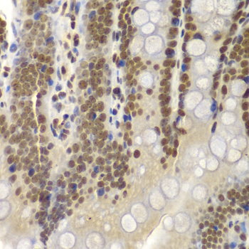 Anti-SMARCB1 Antibody [KO Validated] (CAB5767)