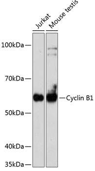 Anti-Cyclin B1 Antibody [KO Validated] (CAB19037)