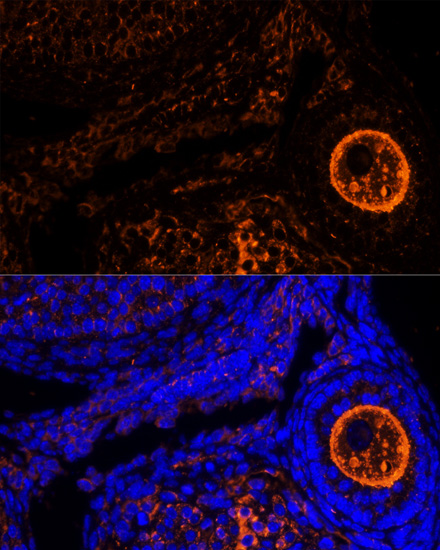 Anti-ZP2 Antibody (CAB10126)