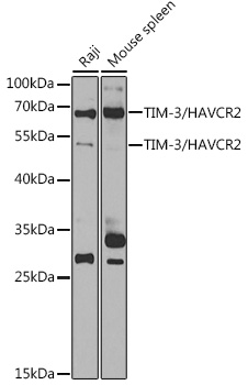 Anti-TIM-3/HAVCR2 Antibody (CAB13443)