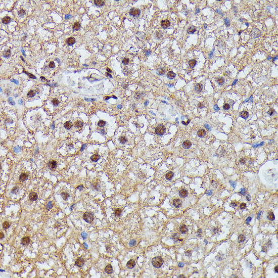 Anti-IGHMBP2 Antibody (CAB16053)