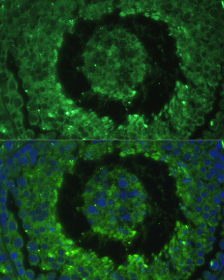 Anti-DEFB121 Antibody (CAB1208)