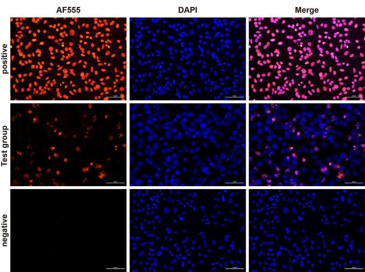 Fluorescence microscope analysis of camptothecin-induced apoptosis of Hela cells.