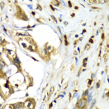 Anti-TMOD4 Antibody (CAB6772)