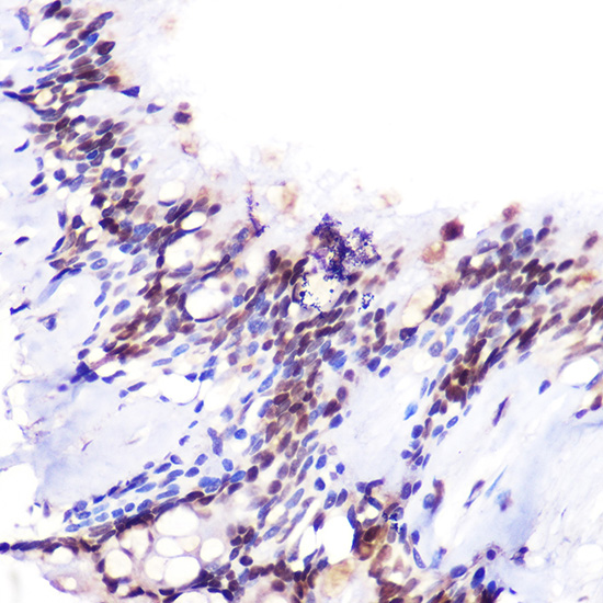 Anti-JMJD6 Antibody [KO Validated] (CAB5840)