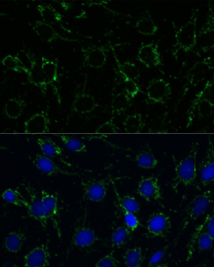 Anti-GLUD1 Antibody (CAB7631)