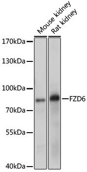 Anti-FZD6 Antibody (CAB10503)