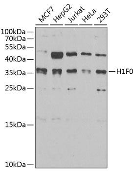 Anti-Histone H1.0 Antibody (CAB6918)