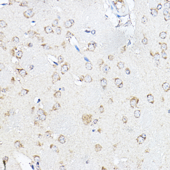 Anti-SCD Antibody [KO Validated] (CAB16429)