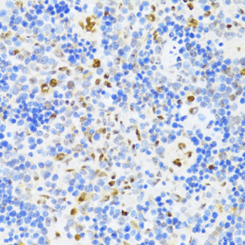 Anti-DDX39B Polyclonal Antibody (CAB8356)