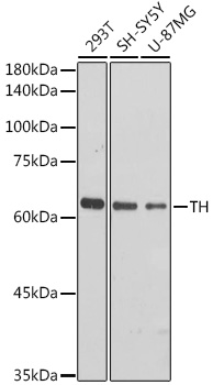 Anti-TH Antibody (CAB12756)