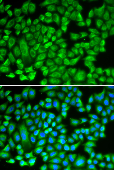 Anti-KAT5 Antibody (CAB13259)