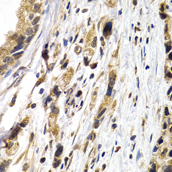 Anti-PTHLH Antibody (CAB1654)