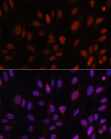 Anti-HOXB1 Antibody (CAB6619)