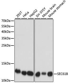 Anti-SEC61B Antibody [KO Validated] (CAB15788)