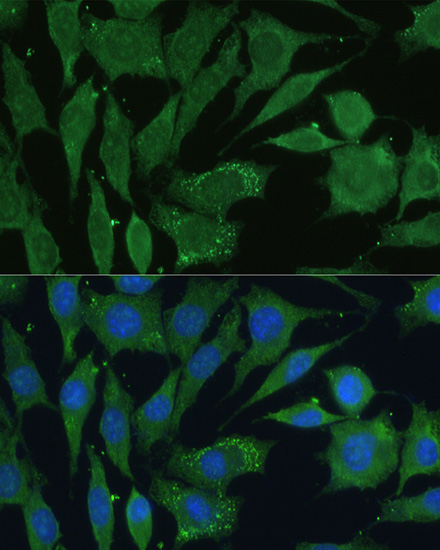 Anti-CGRP Antibody (CAB5542)