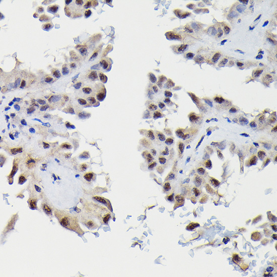 Anti-SNRPE Antibody (CAB5488)