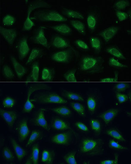 Anti-SPARC Antibody (CAB14494)