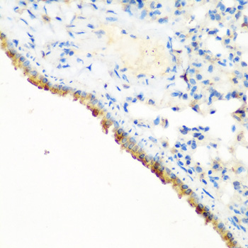 Anti-CBL Antibody (CAB0732)