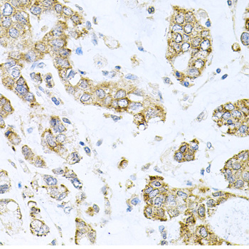 Anti-ALKBH8 Antibody (CAB7142)