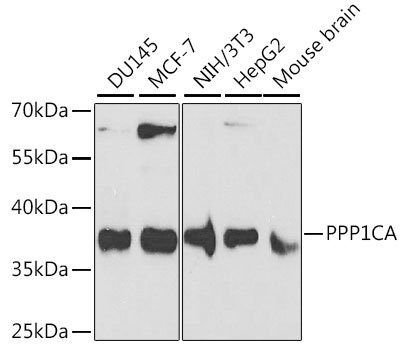 Anti-PPP1CA Antibody (CAB12468)