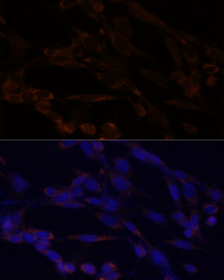 Anti-IKKAlpha Antibody (CAB2062)