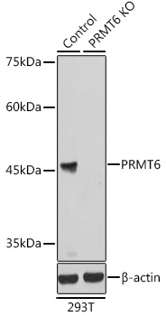 Anti-PRMT6 Antibody [KO Validated] (CAB7814)