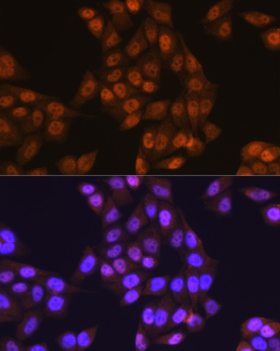 Anti-UBA1 Antibody (CAB12359)